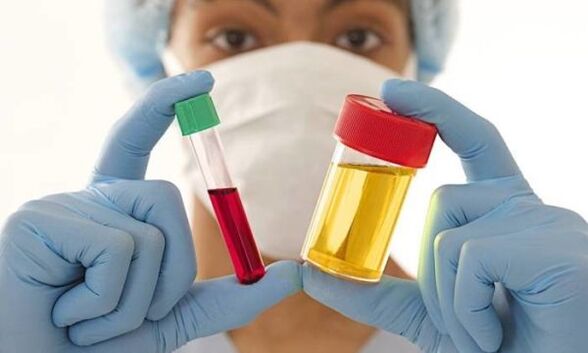 Analyses de sang et d'urine avant une opération d'augmentation mammaire.