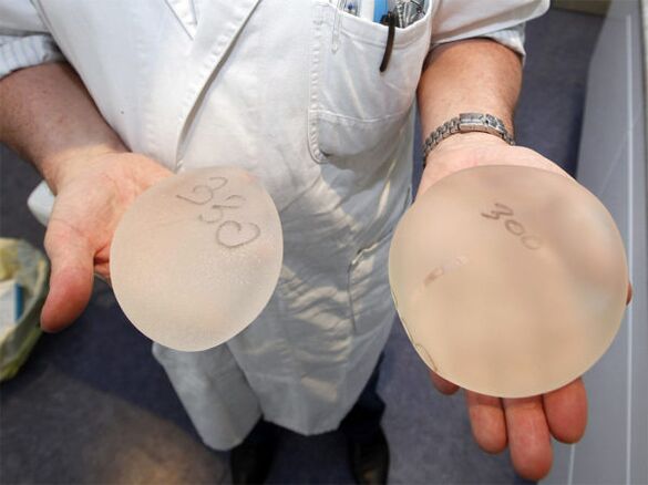 implants mammaires pour agrandir le buste