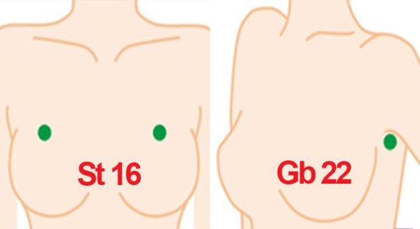 Points de massage sur la poitrine. 